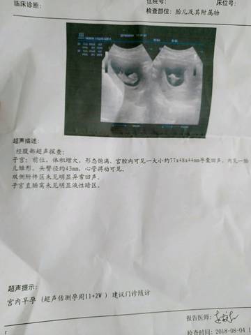 journal_insert_pic_1067695471