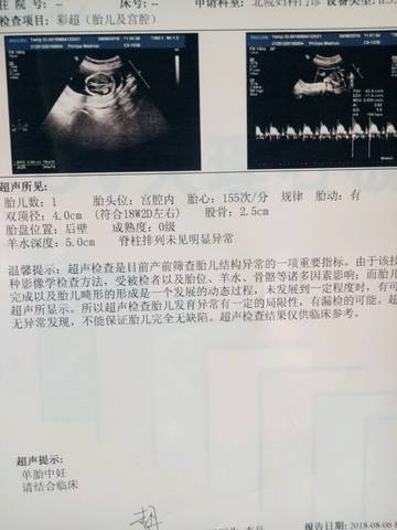 journal_insert_pic_1068738309