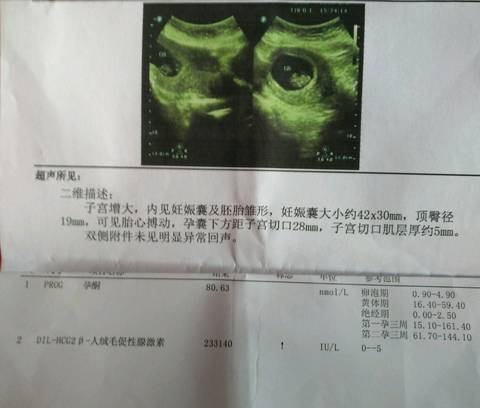journal_insert_pic_1068880026