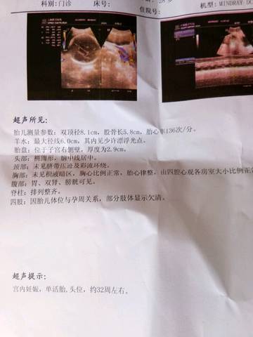 journal_insert_pic_1069436786