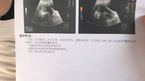 journal_insert_pic_1070061342