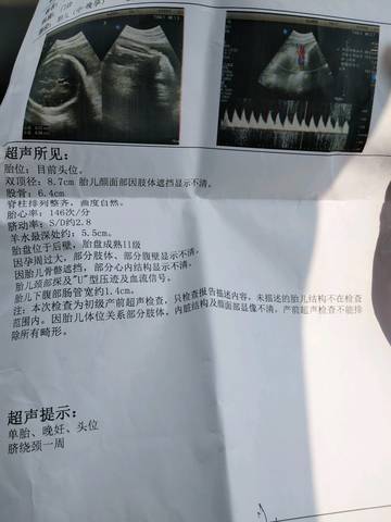journal_insert_pic_1070730986