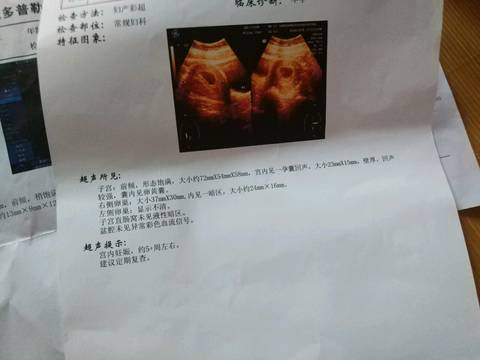 journal_insert_pic_1071452243