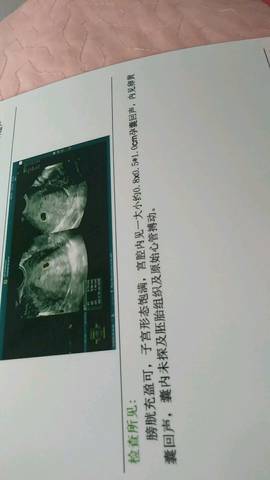 journal_insert_pic_1071400910