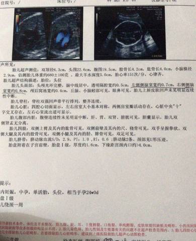 journal_insert_pic_1072058566