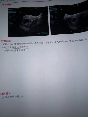 journal_insert_pic_1072828844