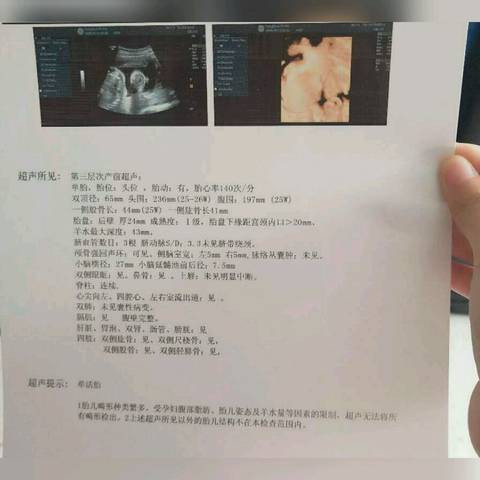 journal_insert_pic_1074649539