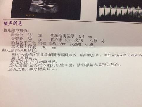 journal_insert_pic_1075182236