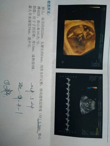 journal_insert_pic_1075761601