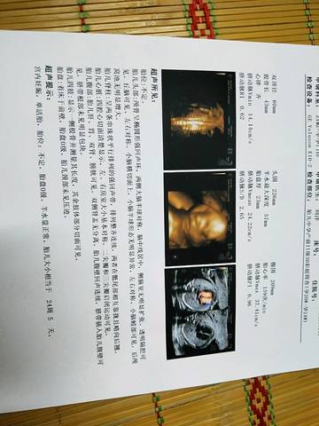 journal_insert_pic_1075635406