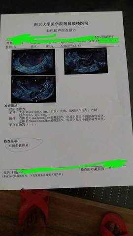 journal_insert_pic_1075499809