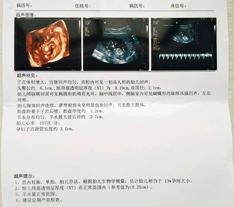 journal_insert_pic_1076519295