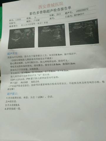 journal_insert_pic_1077600667