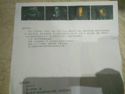journal_insert_pic_1080318636