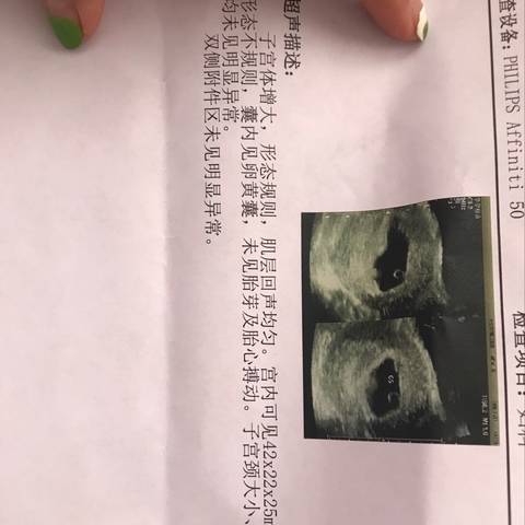 journal_insert_pic_1081831293