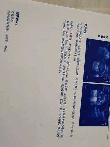 journal_insert_pic_1086305047