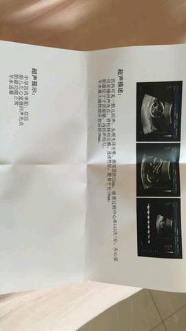journal_insert_pic_1087597604