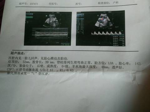 journal_insert_pic_1087383156