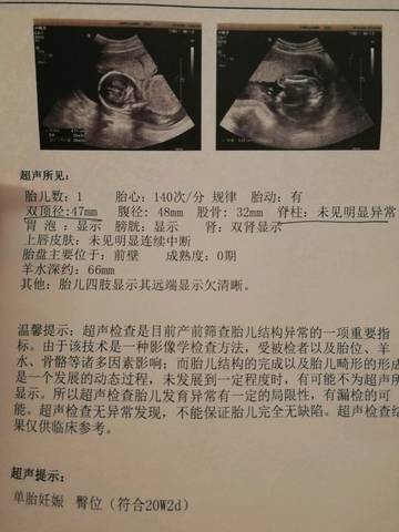 journal_insert_pic_1090704023
