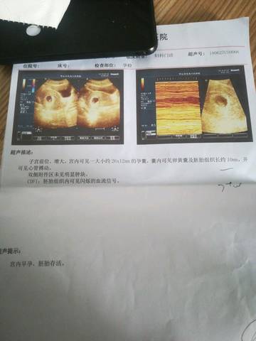 journal_insert_pic_1090218510