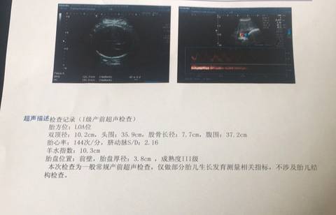 journal_insert_pic_1091177700
