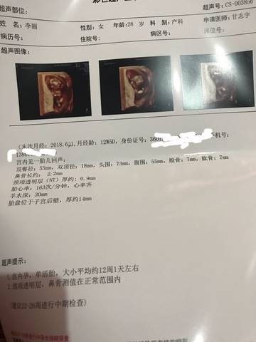 journal_insert_pic_1094639105