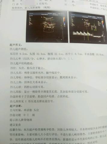 journal_insert_pic_1095992228