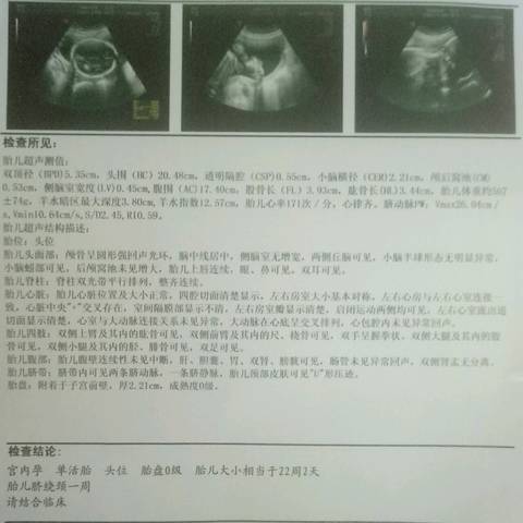 journal_insert_pic_1096260521