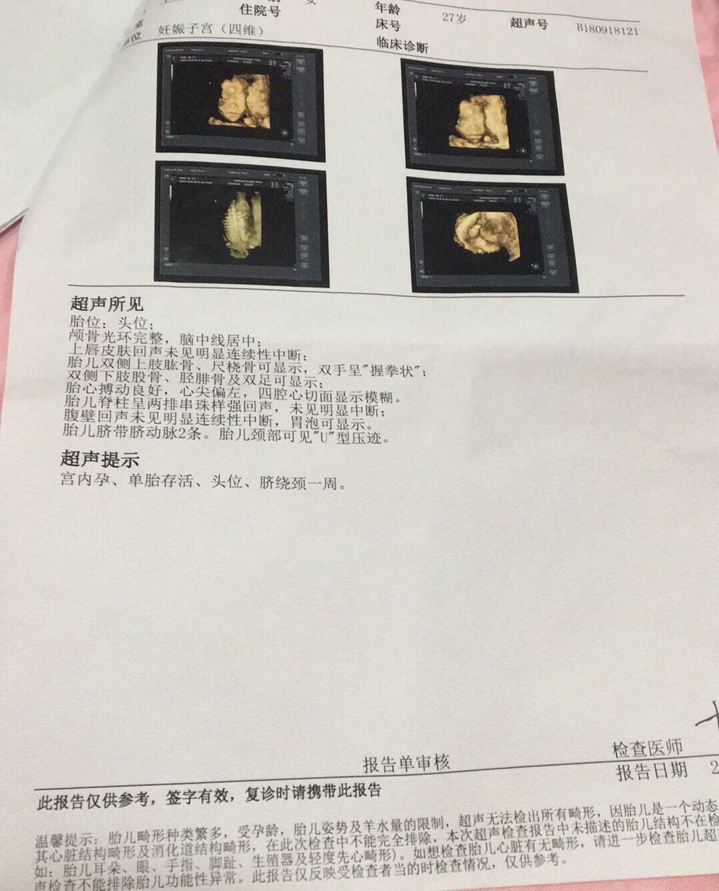 热乎乎的四维出来啦，是男是女哦😊