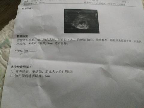 journal_insert_pic_1096355648