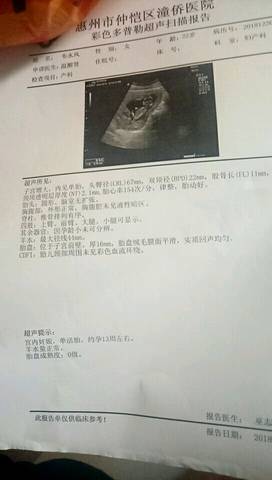journal_insert_pic_1096530261