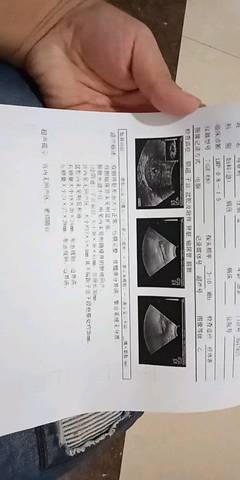 journal_insert_pic_1096245470