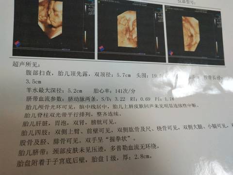 journal_insert_pic_1099636783