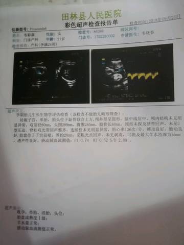 journal_insert_pic_1099605886