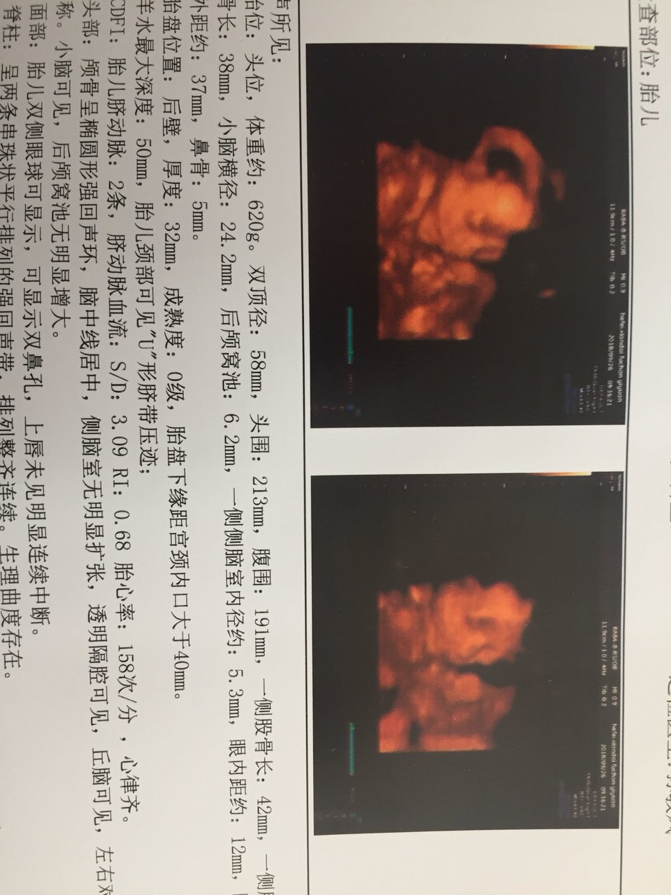 四维，四维，顺利，顺利，通过！😚😚