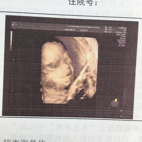 journal_insert_pic_1100579860