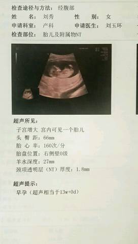 journal_insert_pic_1100220677