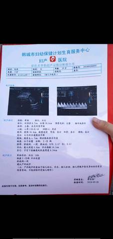 journal_insert_pic_1101218056