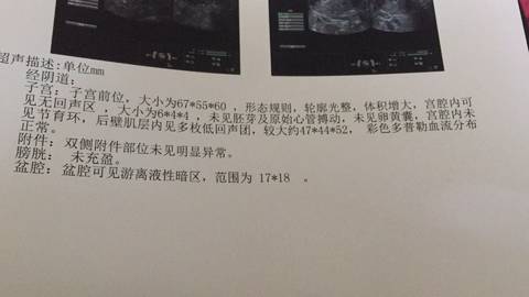 journal_insert_pic_1102077225