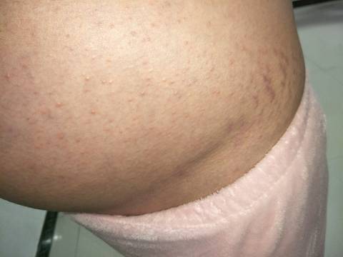 journal_insert_pic_1103535123