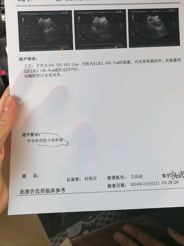 journal_insert_pic_1103178799