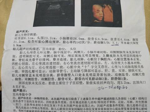 journal_insert_pic_1106586206