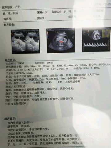 journal_insert_pic_1106720503