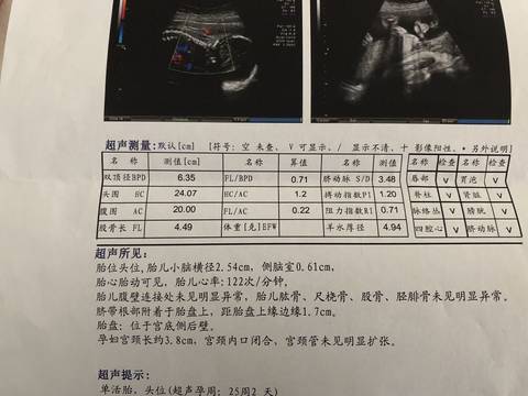 journal_insert_pic_1106908924
