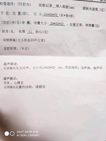 journal_insert_pic_1107936392