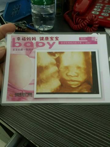 journal_insert_pic_1107836245