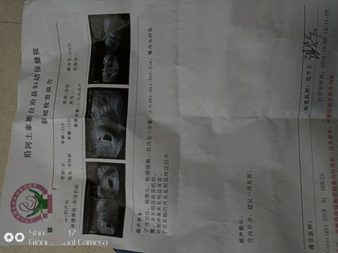 journal_insert_pic_1107898620