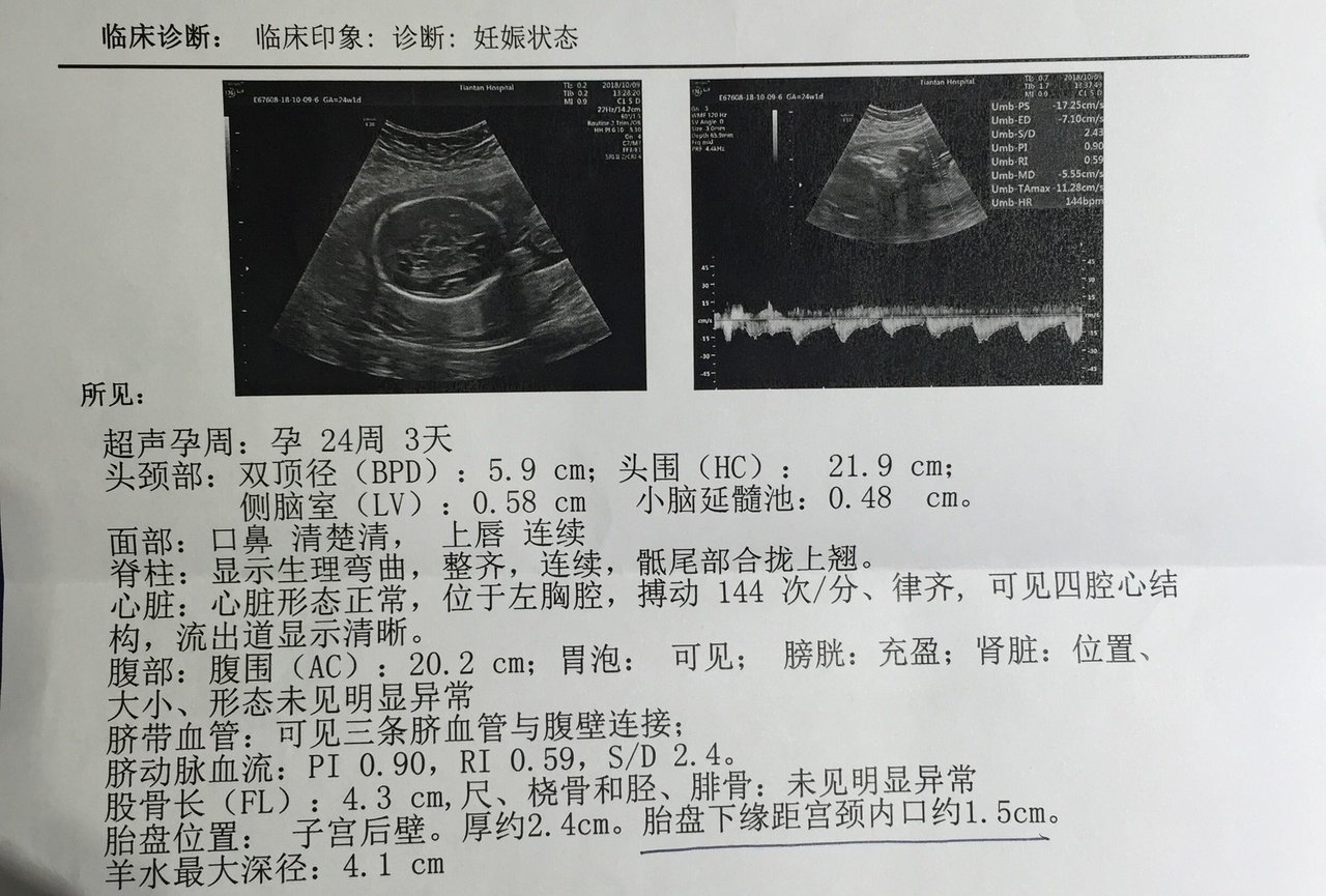 24周大排畸