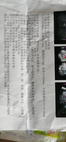 journal_insert_pic_1108509988
