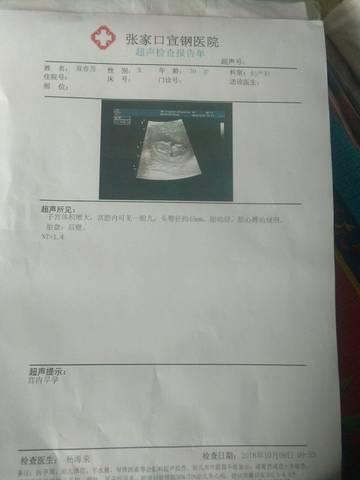 journal_insert_pic_1108458742